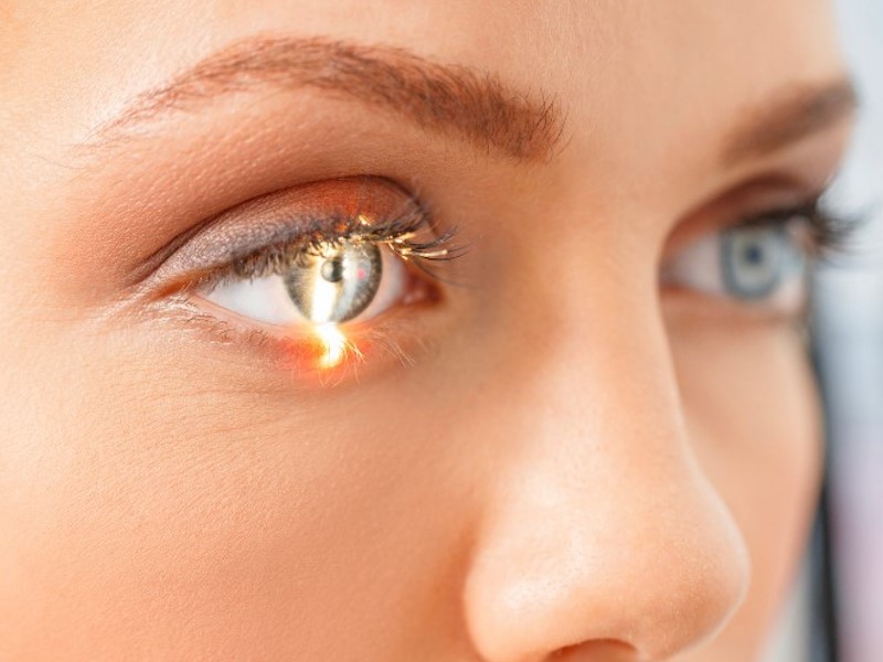 augenärztliche Untersuchung Augen Lichtempfindlichkeit